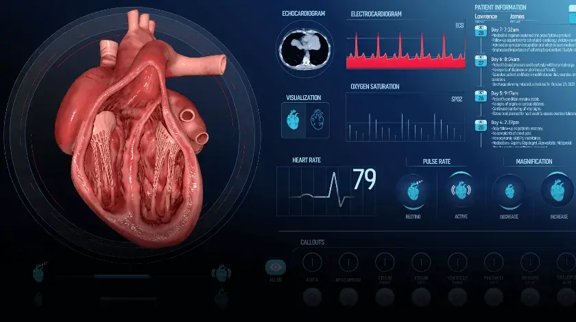 Demo: Echo Cardio